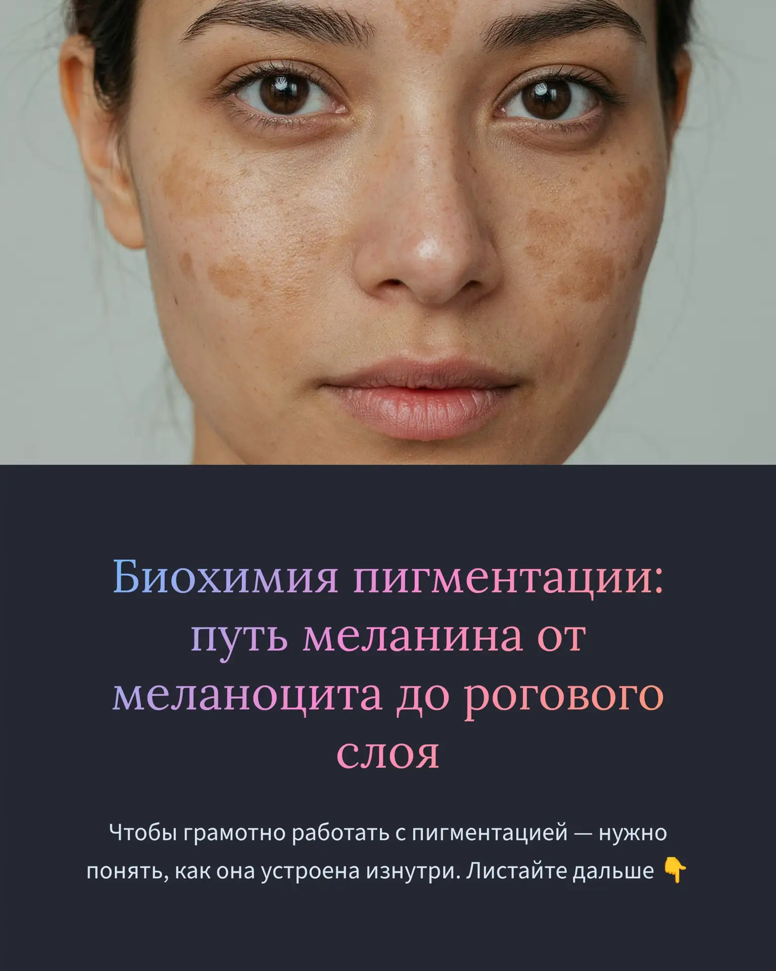 Биохимия пигментации. ГДЕ РАБОТАЕТ КОСМЕТОЛОГИЯ???
