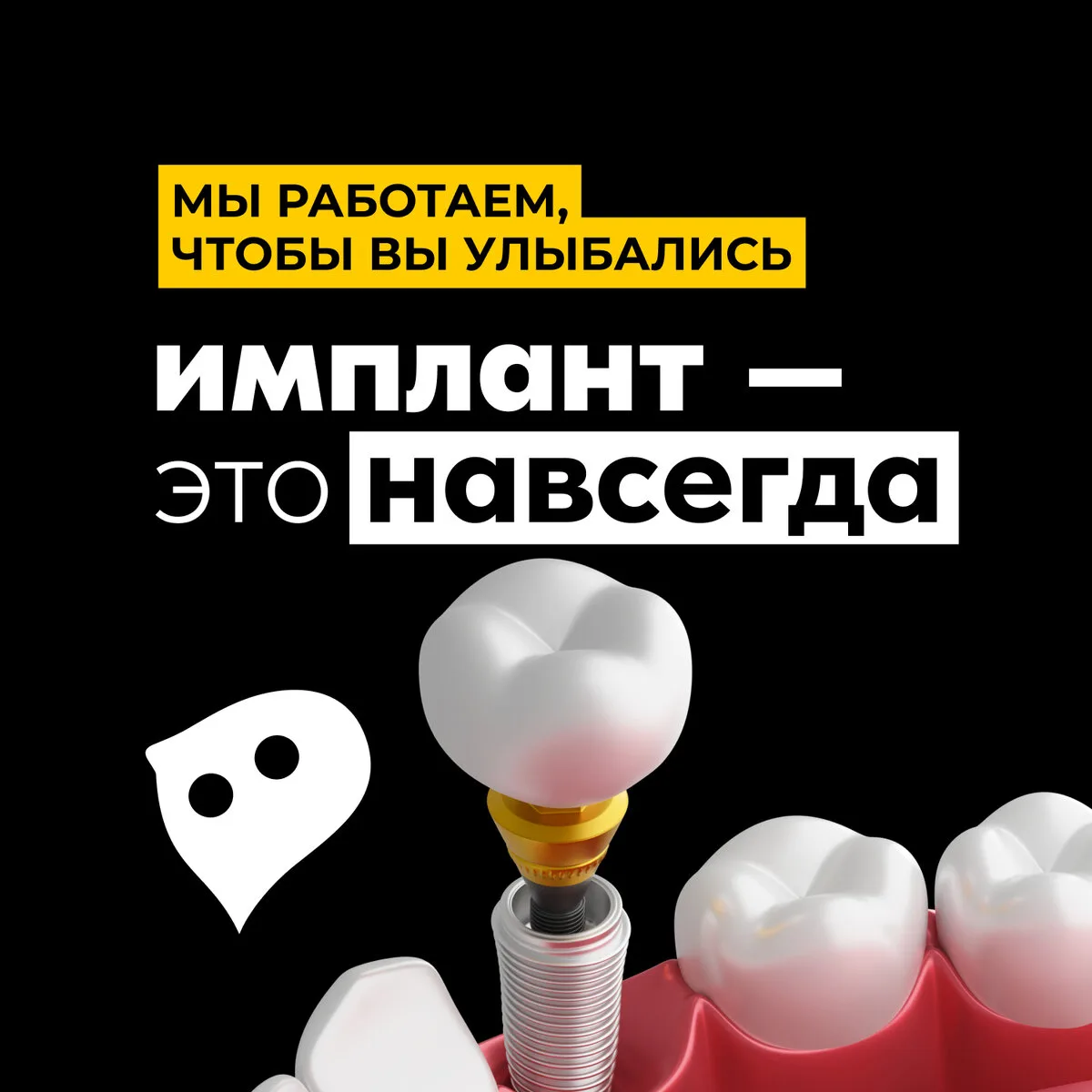 Имплантация зуба за 30 минут в Перми по разумным ценам!