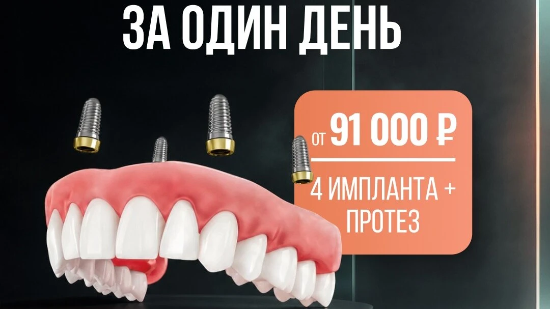 4 импланта зуба + протез челюсти = «под ключ» от 91 000₽