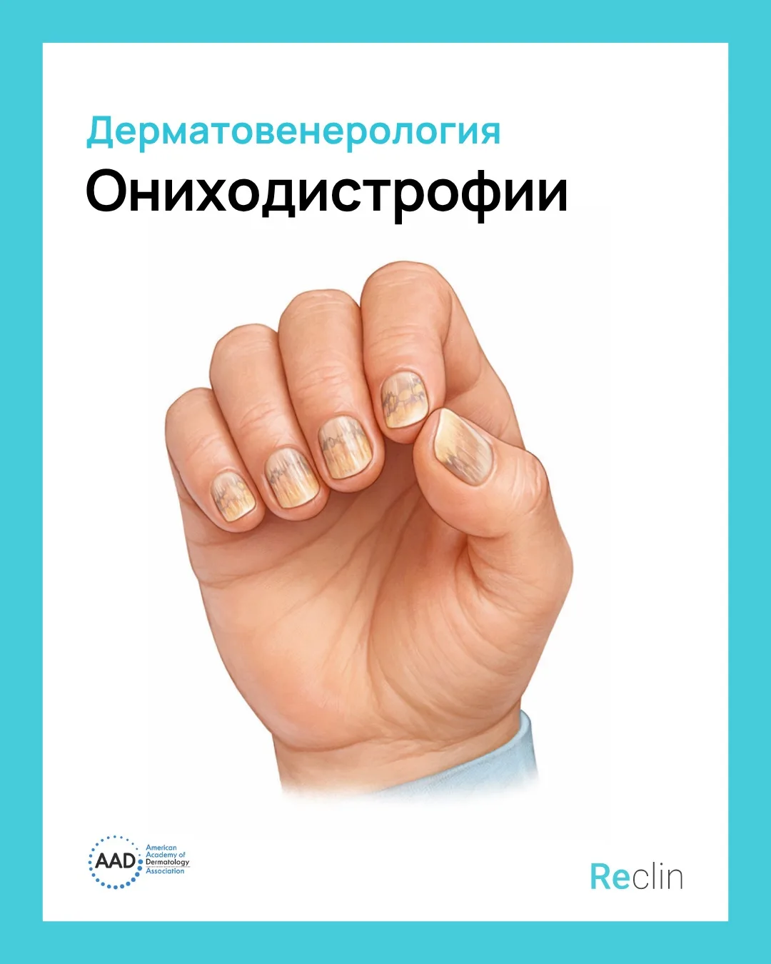💅 ОНИХОДИСТРОФИИ 💅