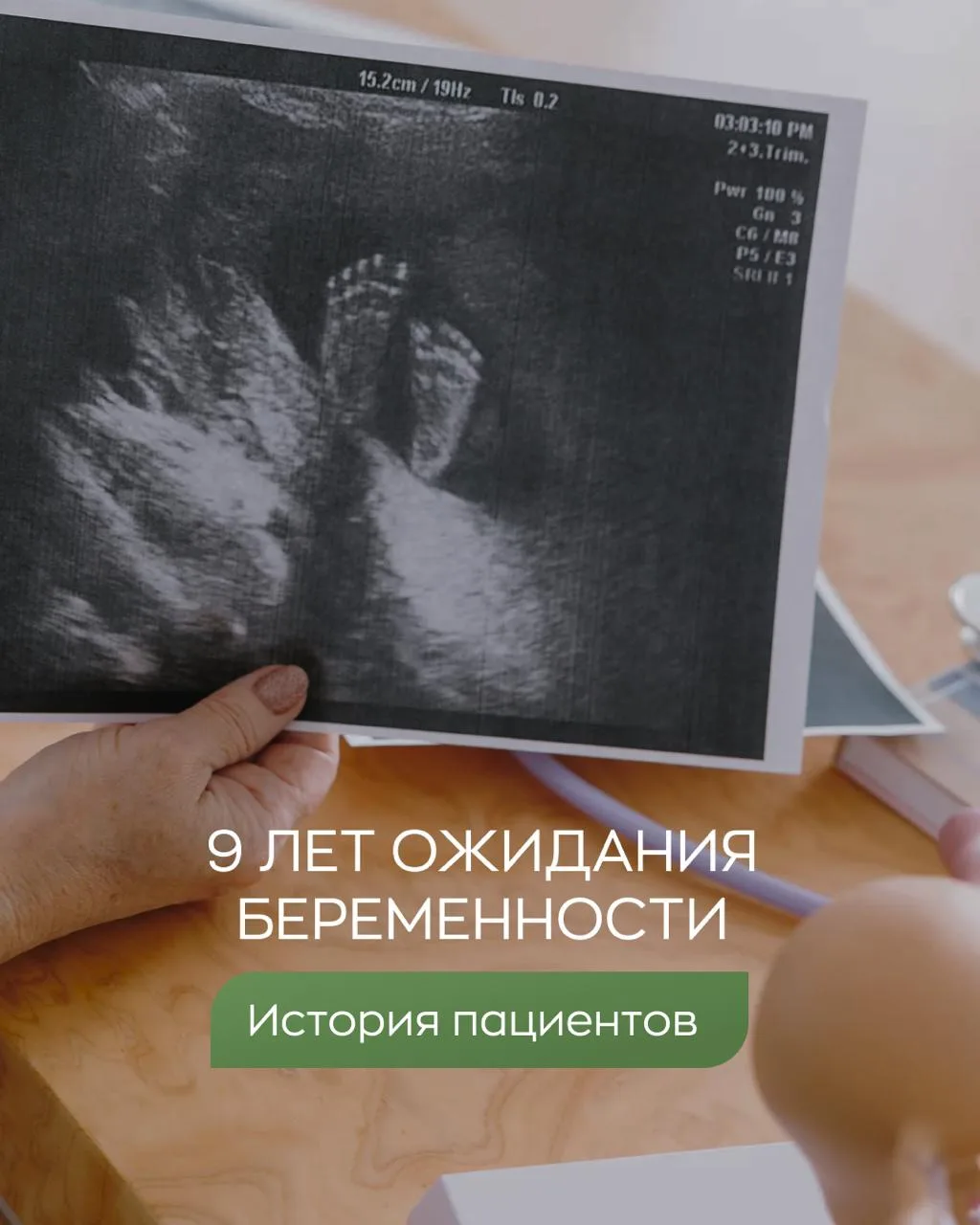 9 лет. Они ждали девять лет.