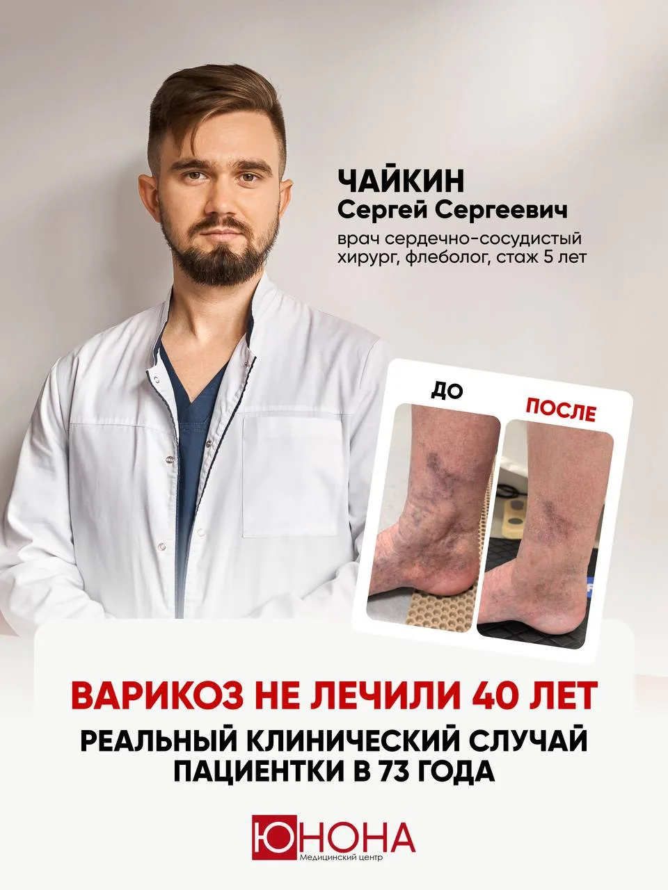 У пациентки варикоз развивался на протяжении 40 лет❗️