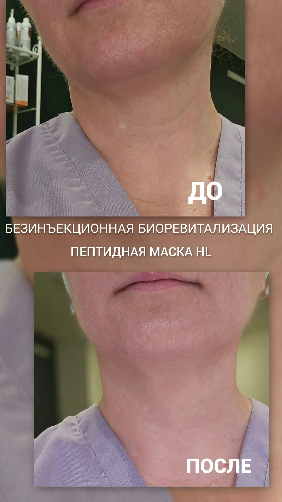 Косметологи регулярно и дисциплинированно делают все те же процедуры, что предлагают св...