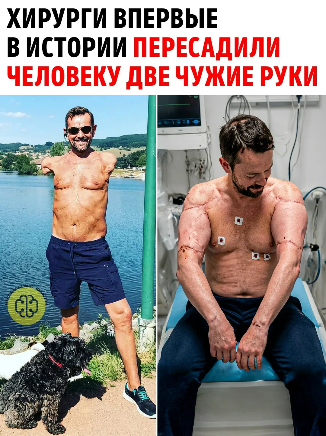 Исландец Феликс Гретарссон выжил после страшного удара в 11 000 вольт и сотворил настоя...
