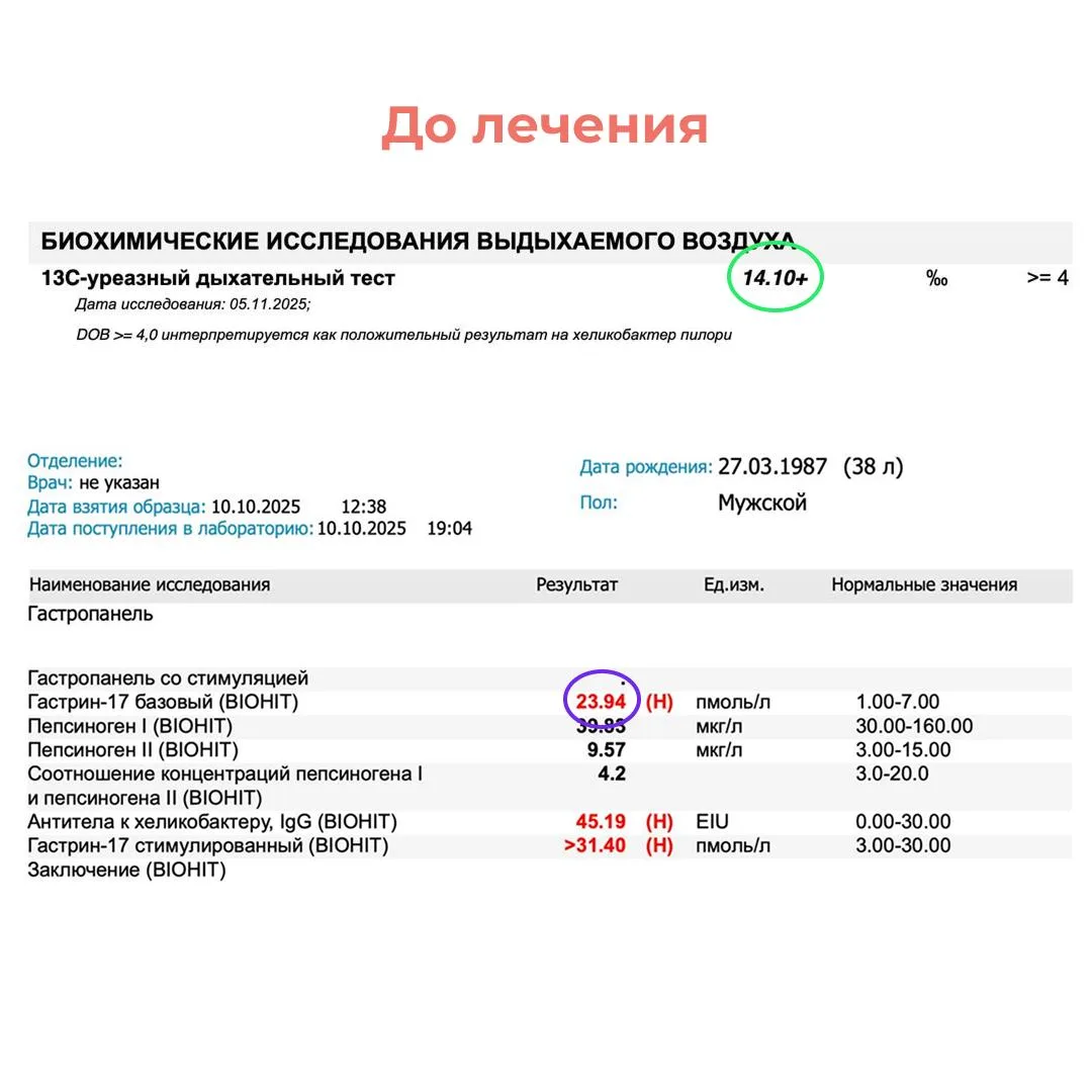 Почему Helicobacter pylori вредит пищеварению?