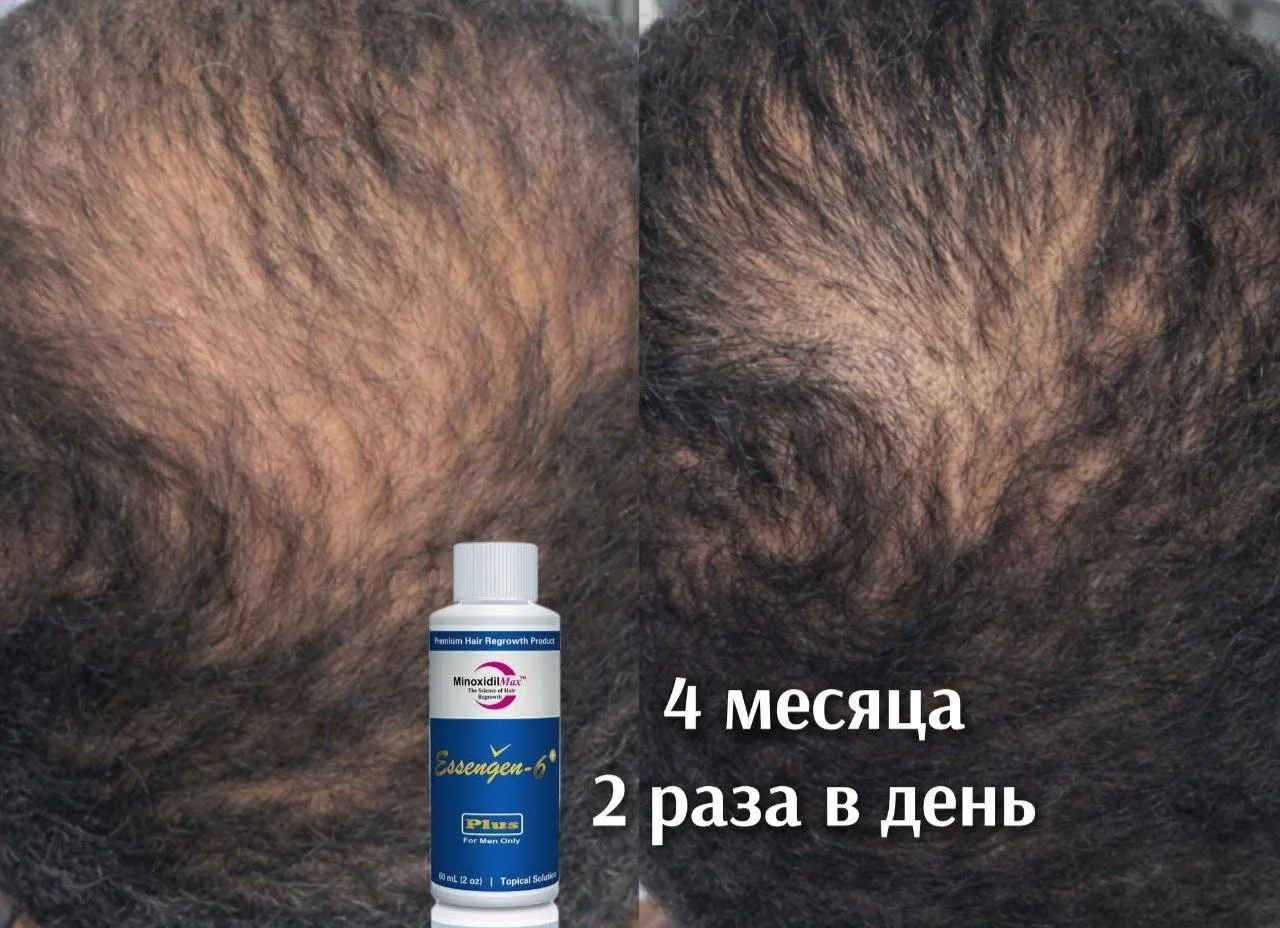 🌱Здесь не плохие первые результаты на очень хорошем лосьоне
