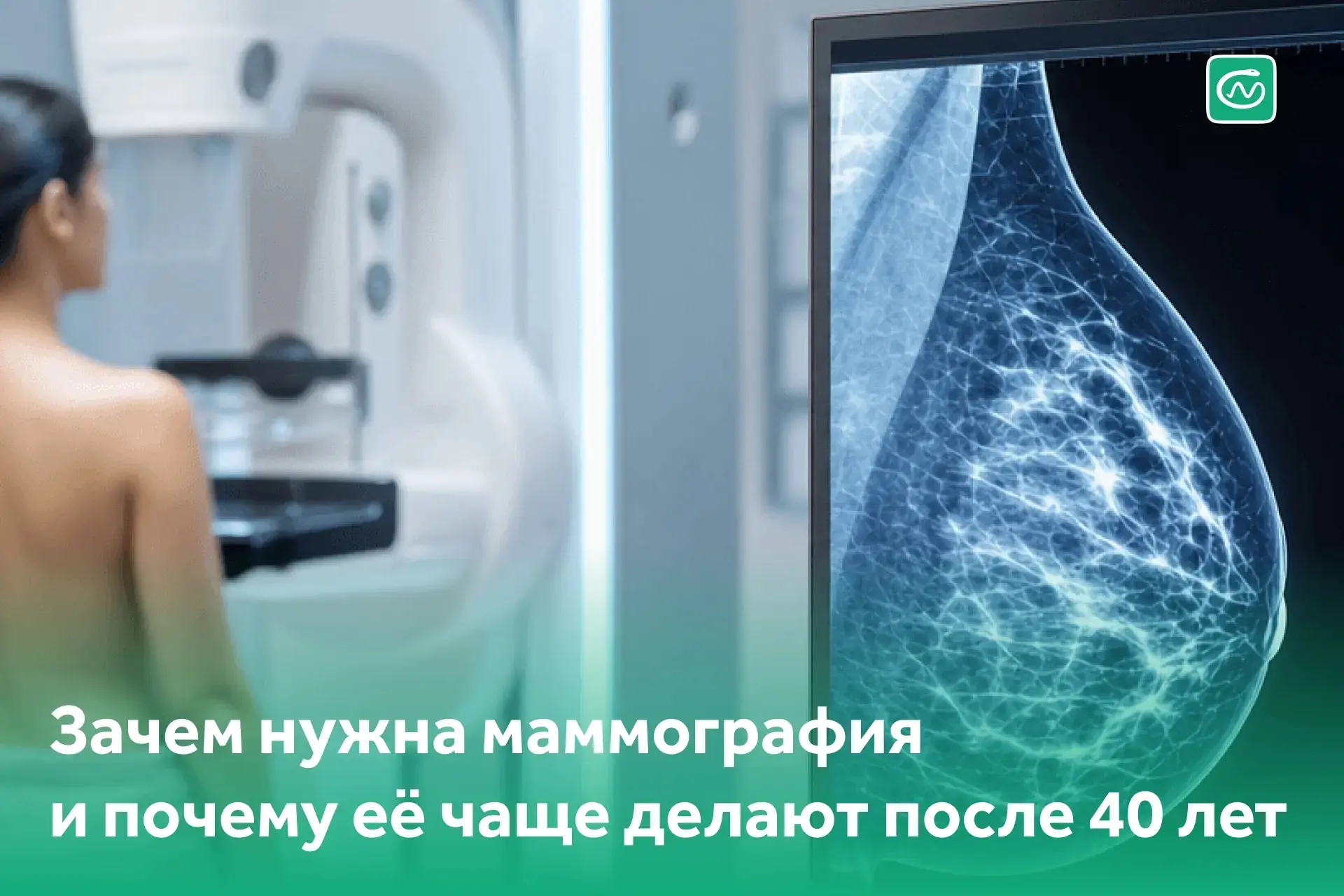 Сегодня разберёмся, почему маммографию назначают после 40 лет.
