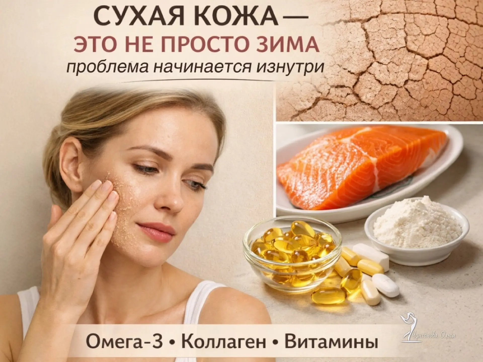 Сухая кожа зимой — это не просто холод и батареи. Если крем помогает на час, а затем снова стянутост