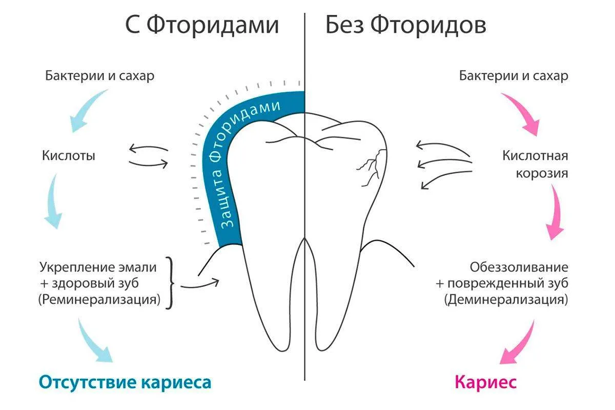 Как выбрать правильную пасту с фтором 

 ✅ взрослым — с содержанием фтора 1000–1500 ppm;

 ✅ детям —