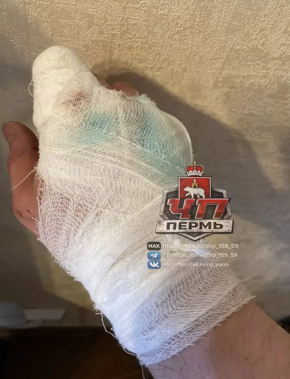 😱❗️«Налетели без единого слова»: в Перми орудует банда из 5-7 подростков, избивающая людей на улица