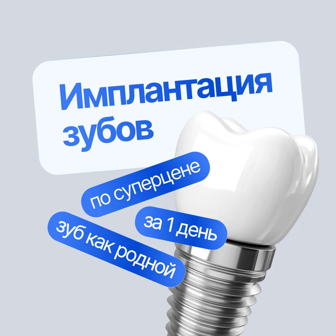 Имплантация зуба за 1 приём в Сургуте от 26 000 ₽