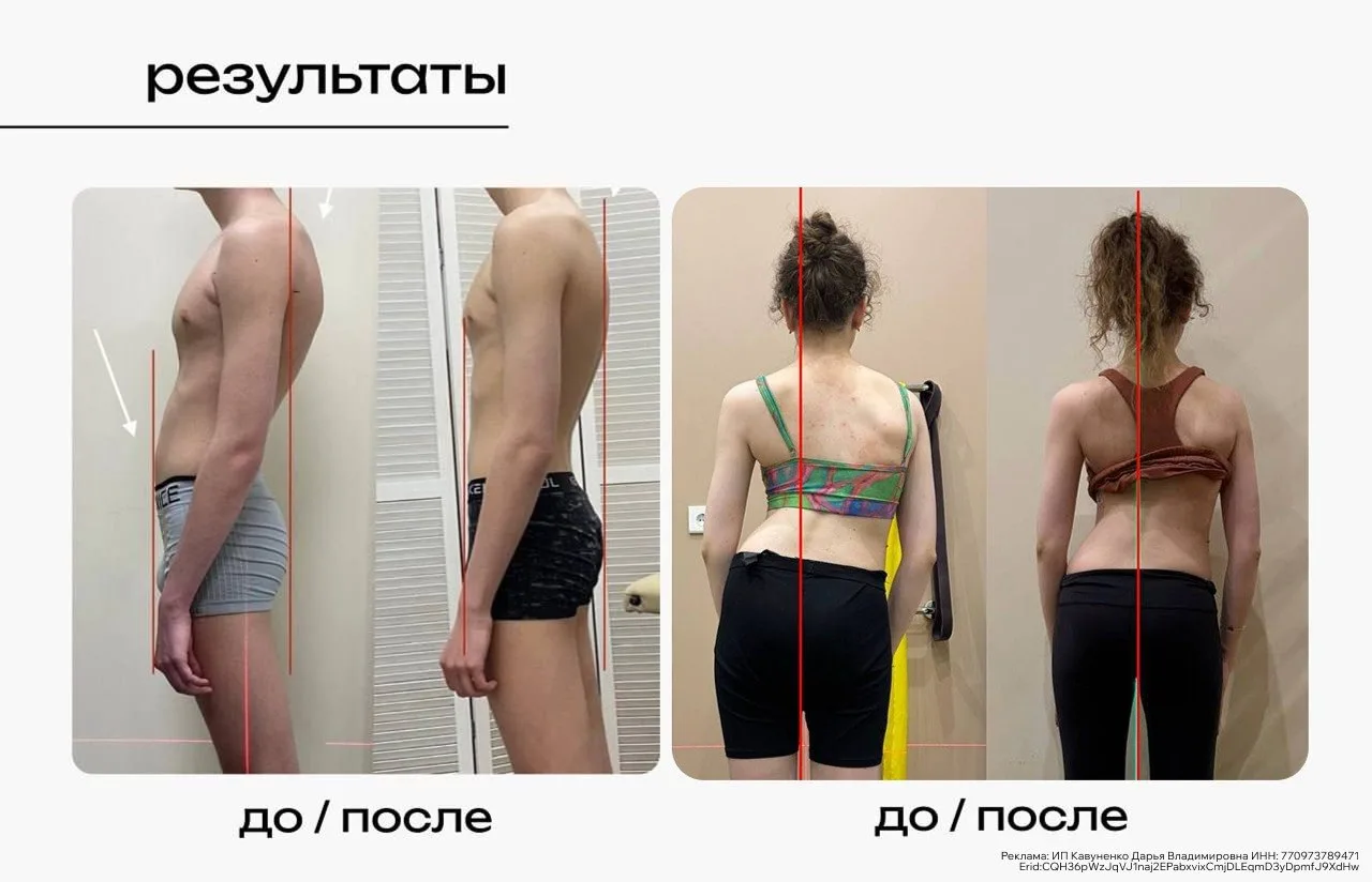 Чем дальше в календарь, тем чаще я чувствую боль в спине после простого сидения за комп...
