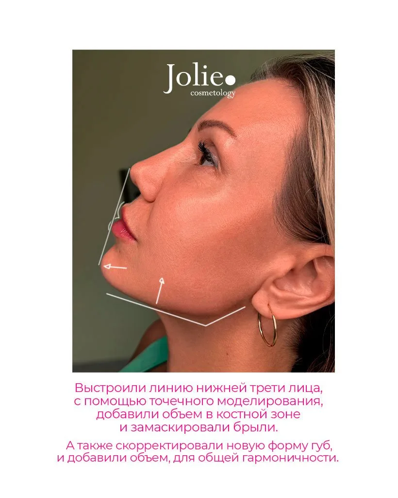 Изображение 3 к публикации «Центр косметологии Jolie»