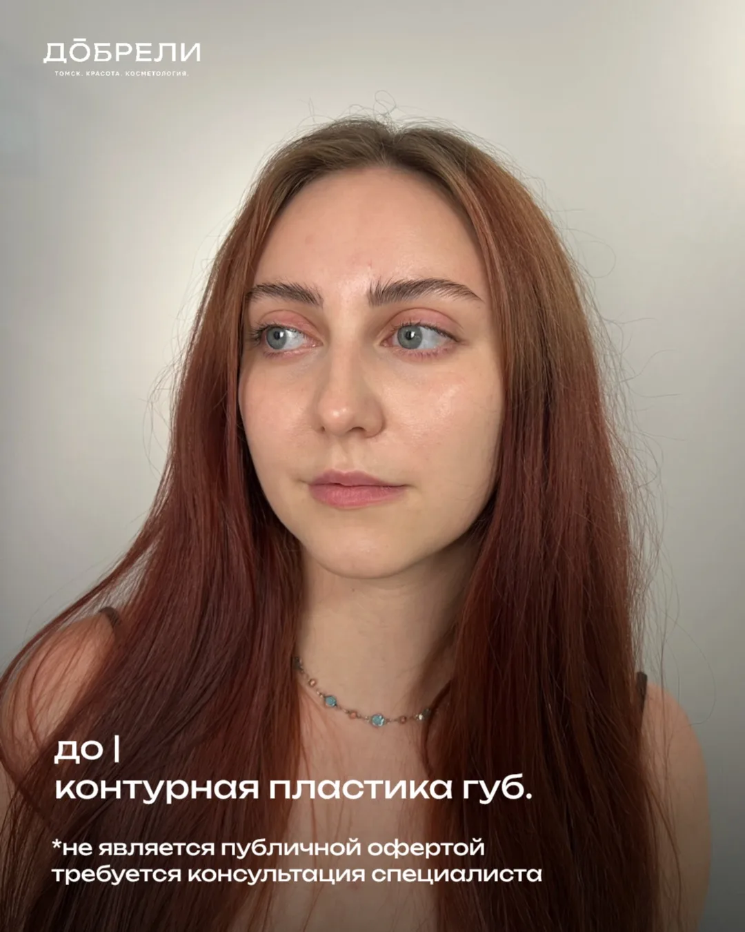 Закончилась акция на увеличение губ: