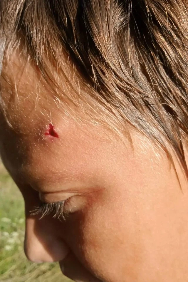 🚑 В Богучаре подростку разбили голову из-за громкой музыки