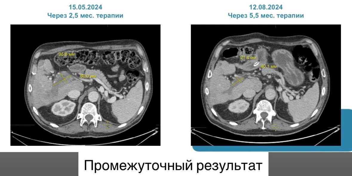 Дорогие друзья! Сегодня мы хотим поделиться историей нашего пациента — три года лечения...