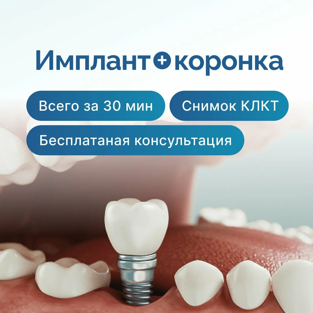 Специально для тех, кому требуется имплантация зубов