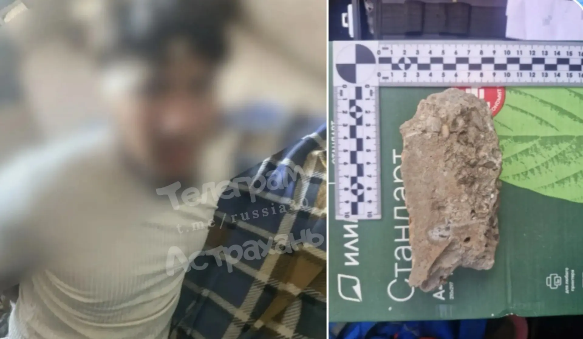 ⚡️В Астрахани госпитализирован 43-летний мужчина с травмами. Врачи посчитали повреждения криминальны