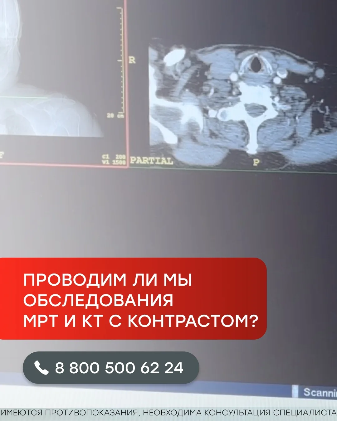 ✅Да, в АйКлиник проводятся исследования магнитно-резонансной томографии (МРТ) и компьют...