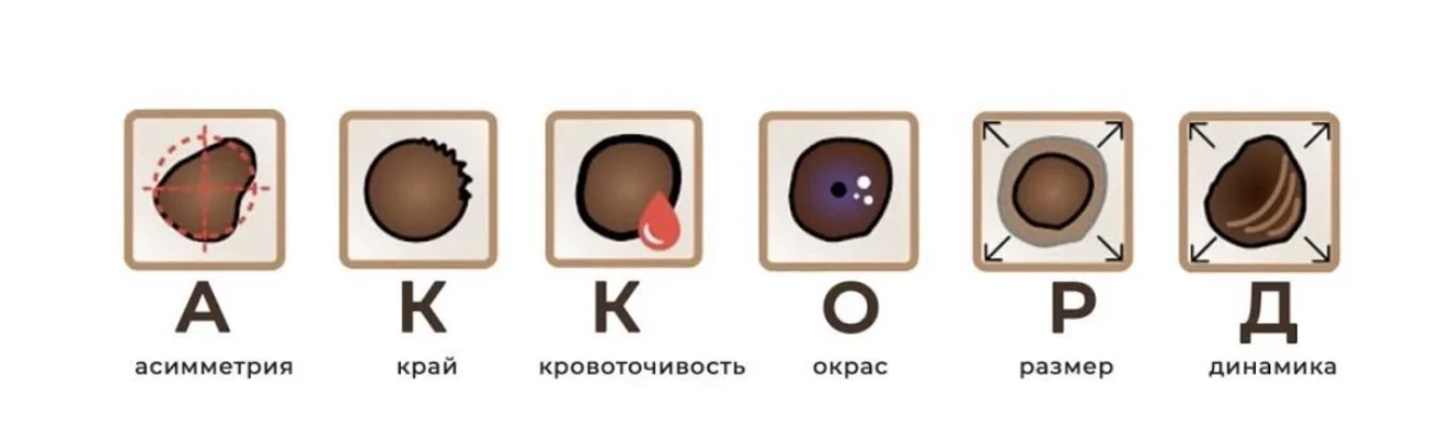 🍏🎗️ День диагностики меланомы