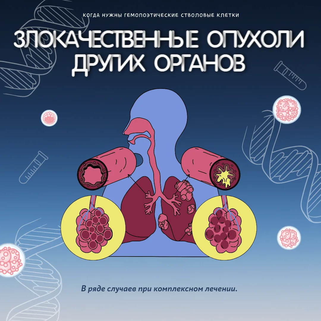 Спасти жизнь и найти своего генетического близнеца  🩸Продолжается неделя популяризации донорства кро
