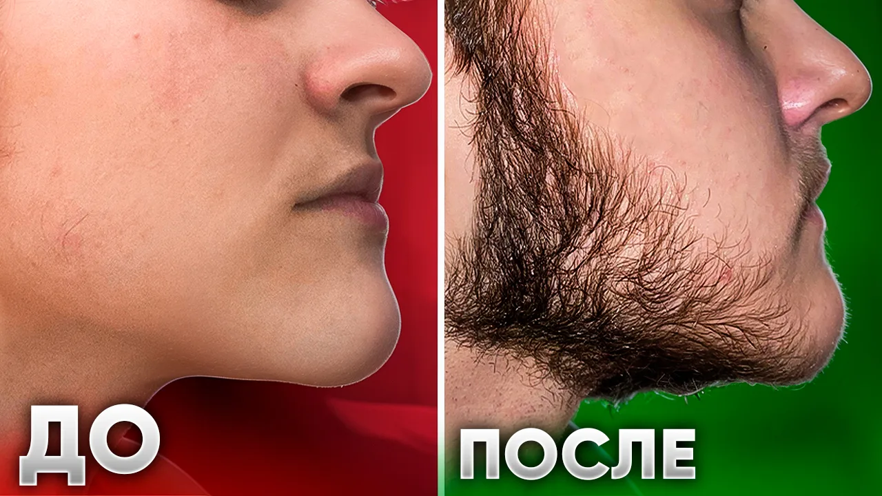 Мощное ДО/ПОСЛЕ в отращивании бороды с нуля! Сегодня на обзоре подписчик со светлыми во...