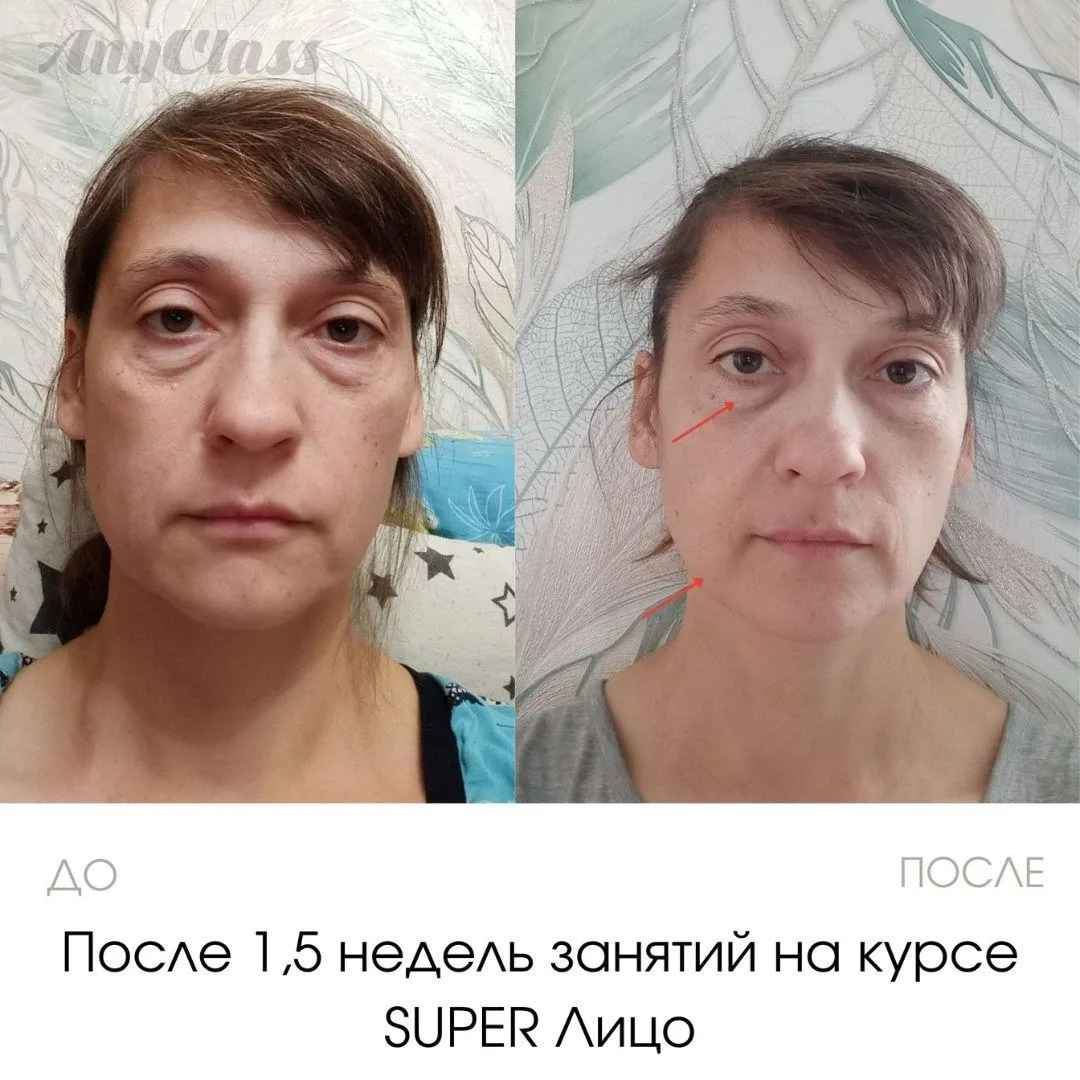 Из-за гимнастики появятся новые морщины👀  Это один из самых распространённых мифов о гимнастике, с к