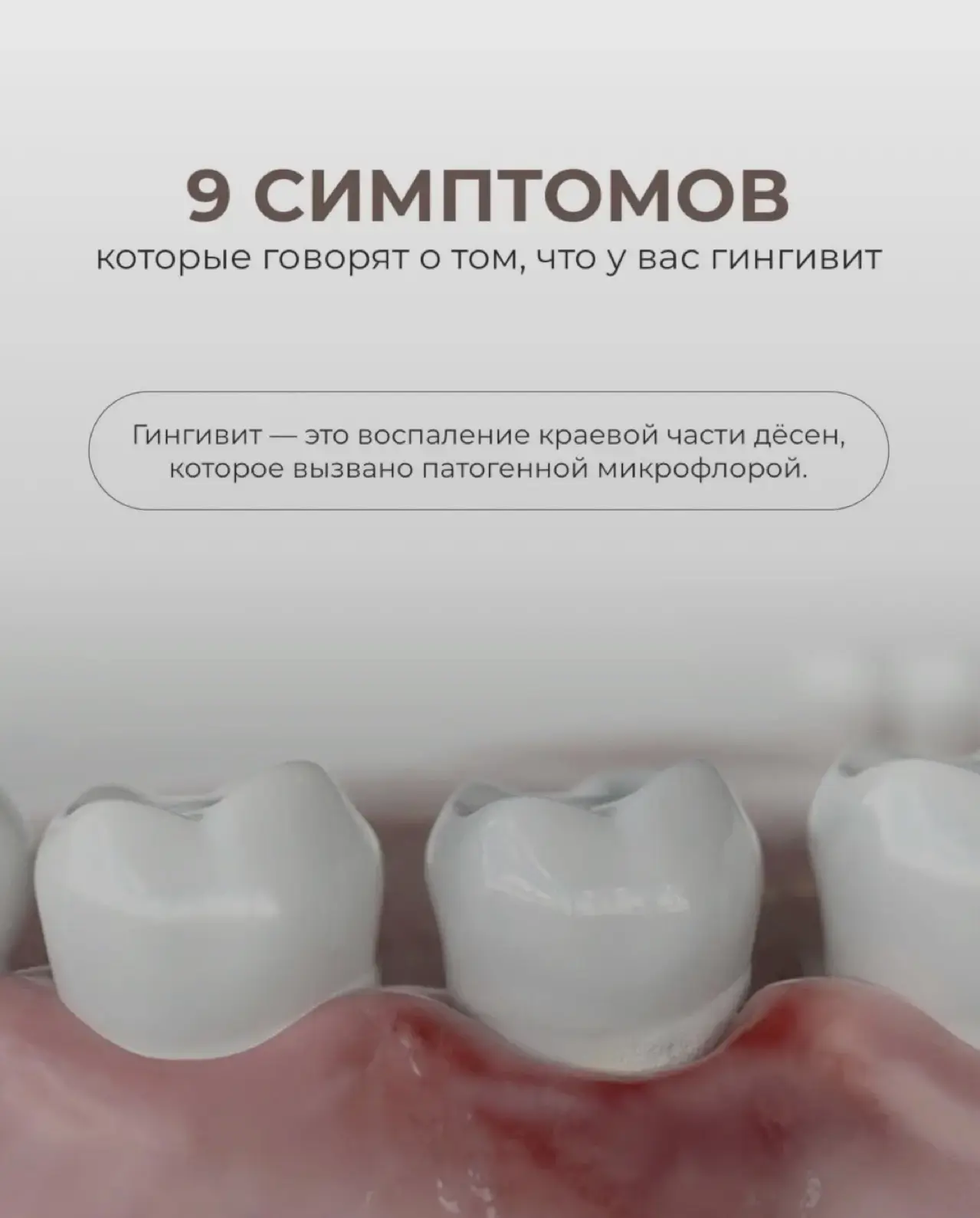 🦷 Внимание, важная информация о здоровье ваших дёсен! 🦷

Гингивит — это воспаление дёсен, и на ран