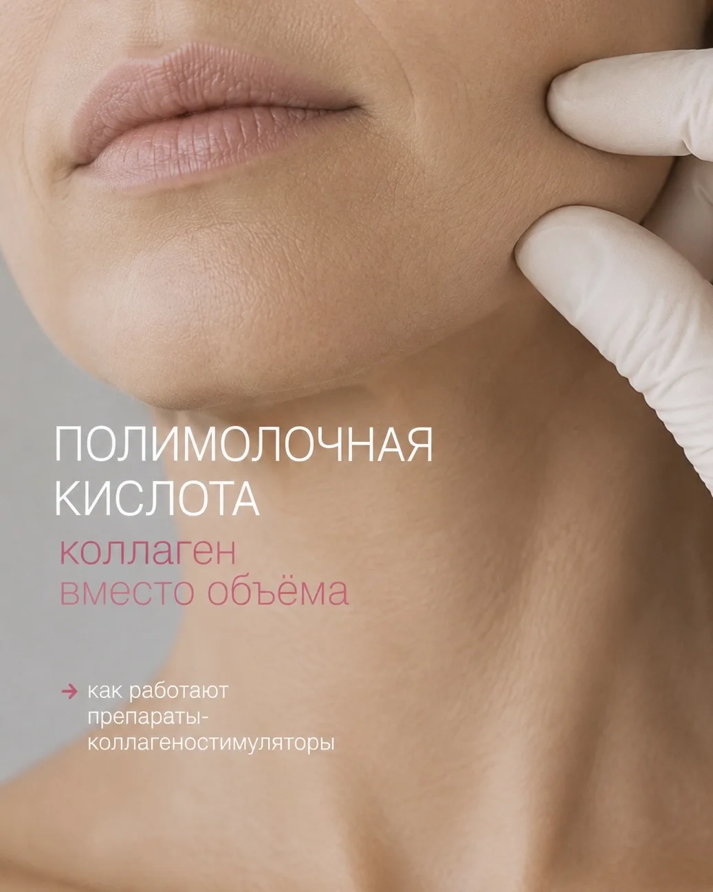 Полимолочная кислота стимулирует выработку собственного коллагена, помогая коже постепе...