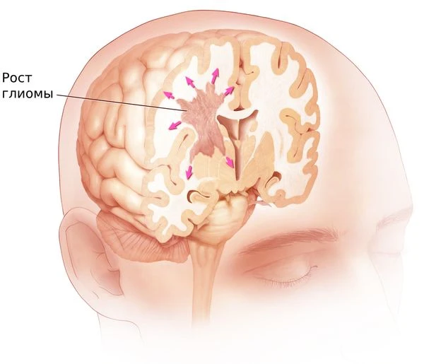 🧠 Российские ученые предложили новый способ лечения глиомы

Междисциплинарный консорциум специалист