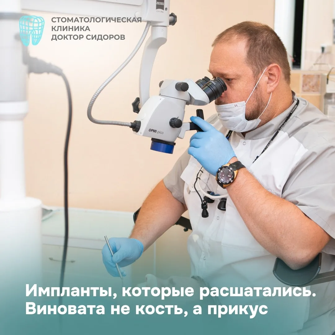 ⚙️ Импланты, которые расшатались. Виновата не кость, а прикус