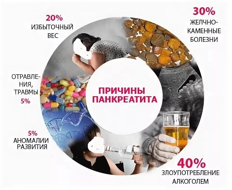 🚨 «Тихий враг» в животе: почему панкреатит не прощает легкомыслия