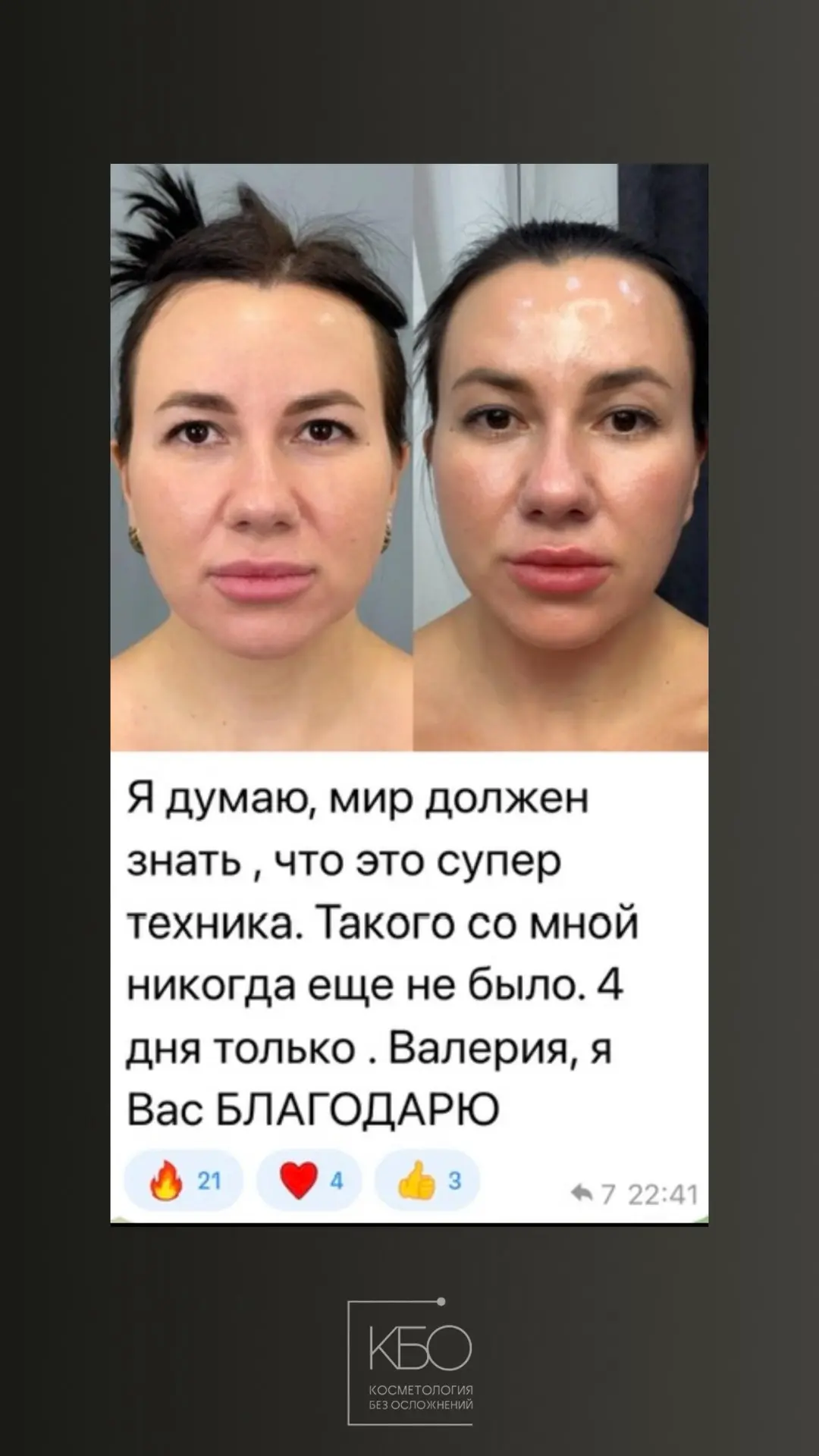Это просто чудо! 
Не устаю удивляться, насколько по разному  может работать один препарат..  увидимс