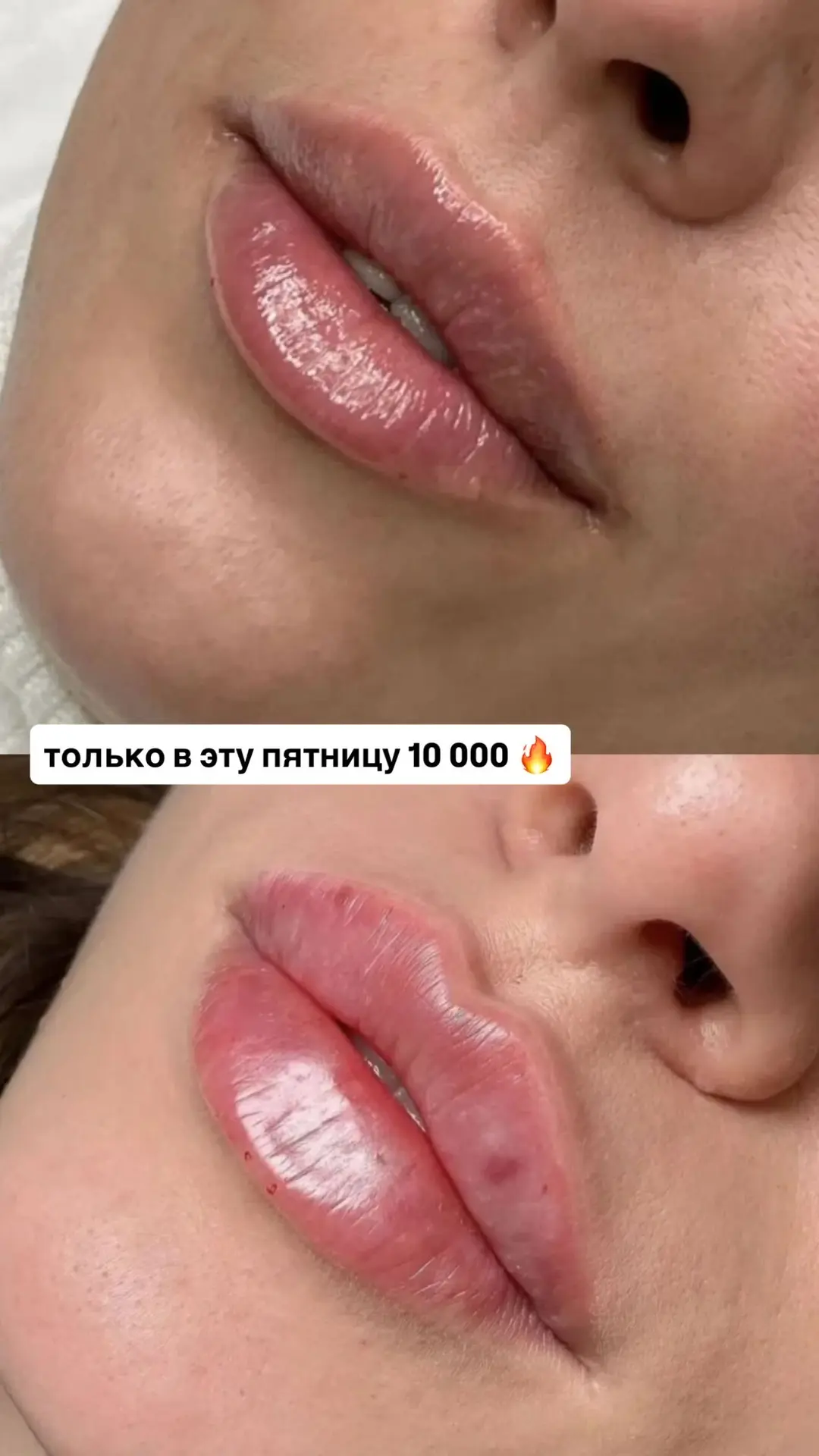 СПЕЦИАЛЬНЫЕ ПРЕДЛОЖЕНИЯ

прием врача косметолога 05 июня! 

ботокс лица FULL FACE от 10 000 руб
бото