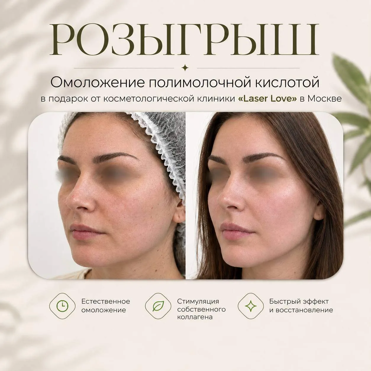 Дарим омоложение полимолочной кислотой, одной из наших подписчиц💋