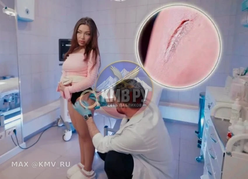 😨 22-летняя теннисистка из Кисловодска едва не погибла после липофилинга бедер