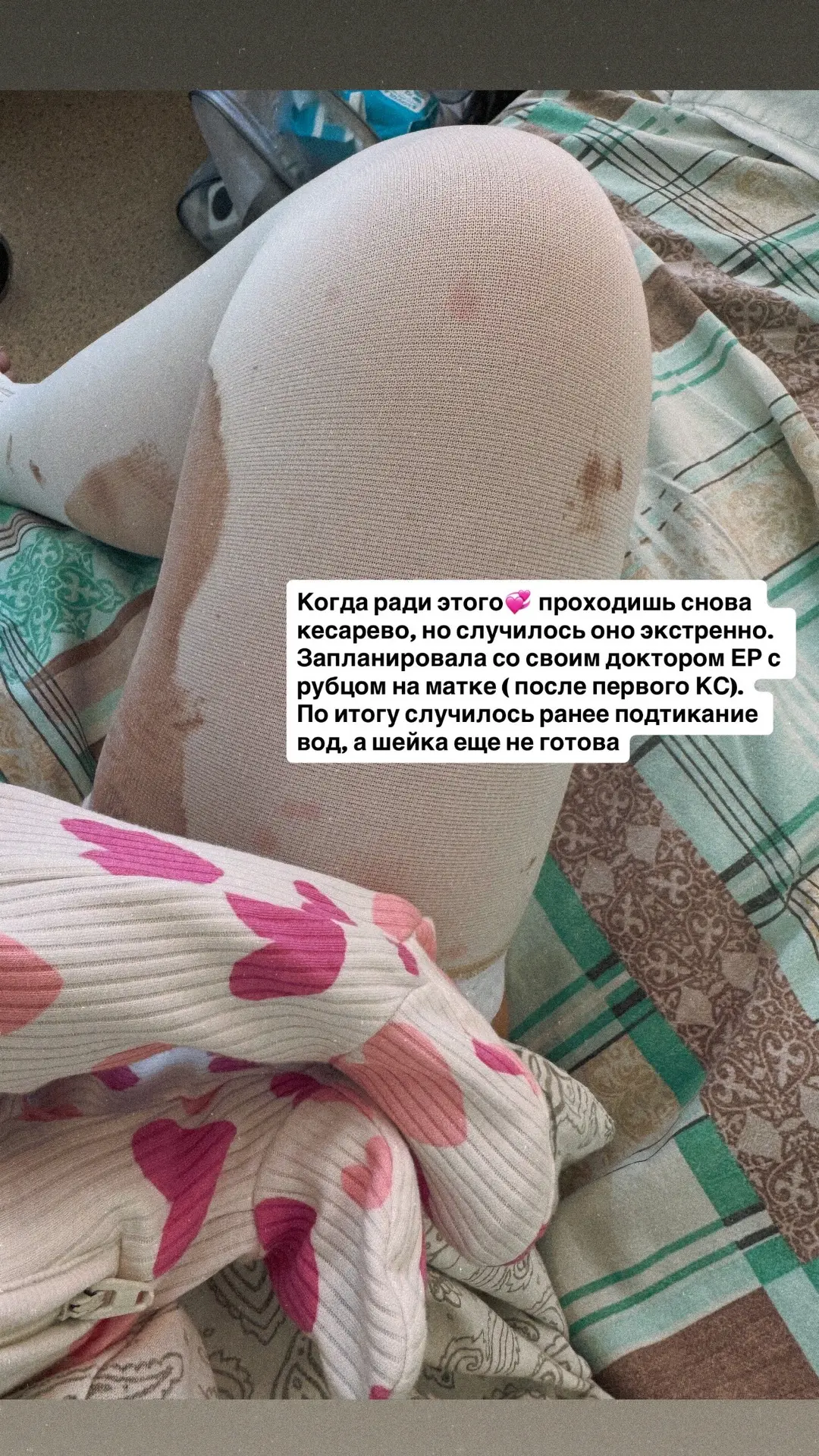 С субботы (13.06) я мама двоих🤭

Дочь родилась в +/- ПДР
3650 кг и 55 см🩷