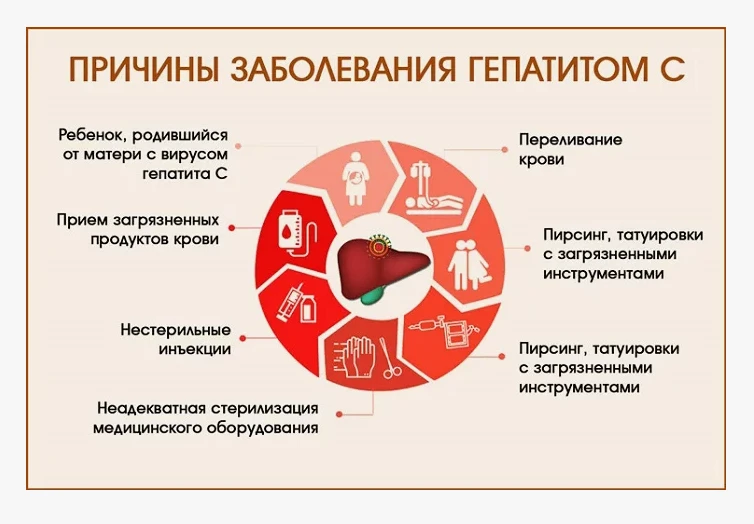 Гепатит С: причины заболевания.❗️