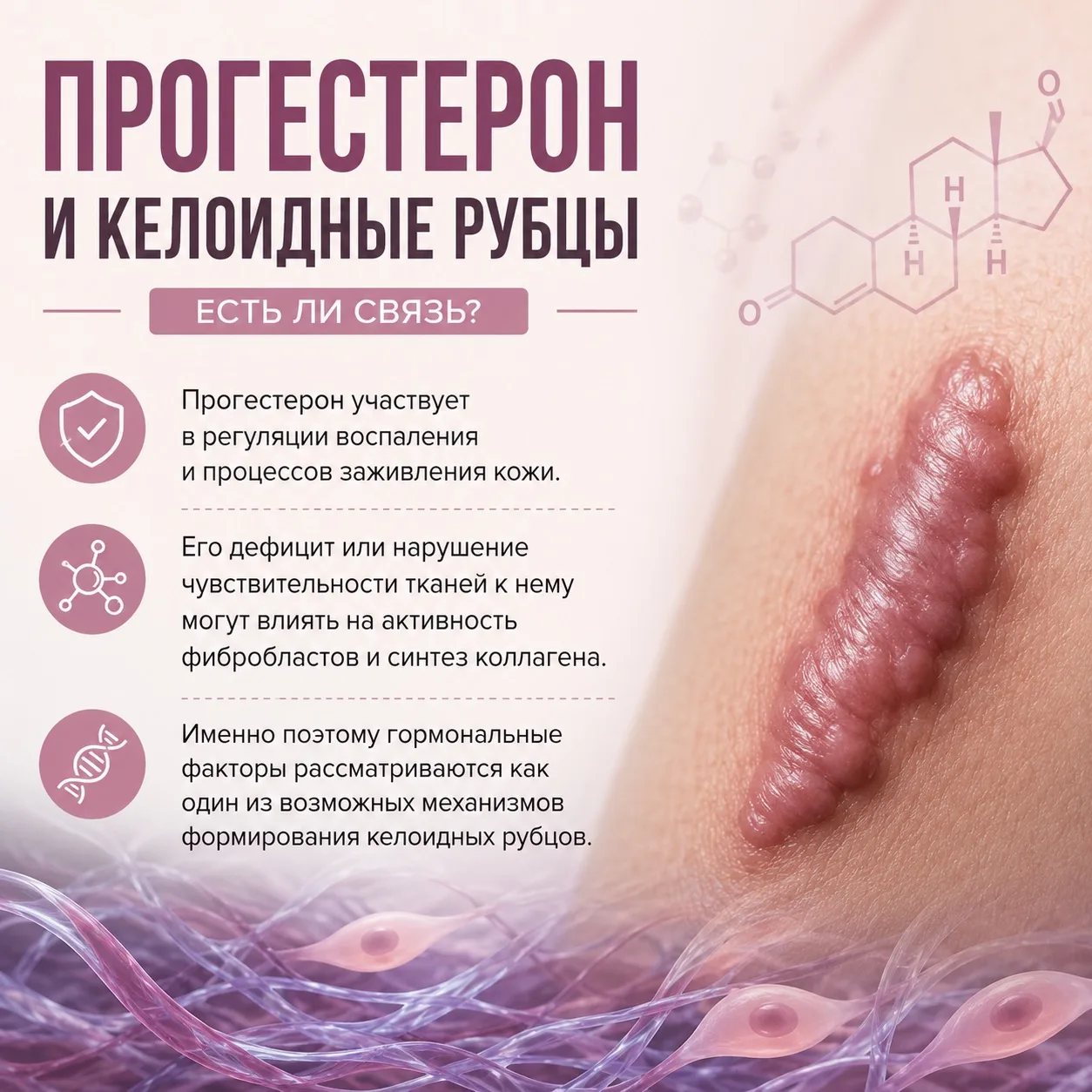 📌 Возможна ли связь между дефицитом прогестерона и келоидными рубцами?

▪️ Регуляция воспаления и с