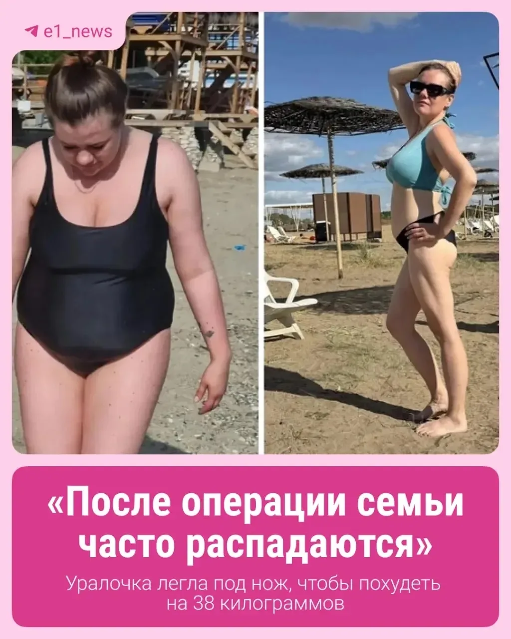 «После операции семьи часто распадаются»