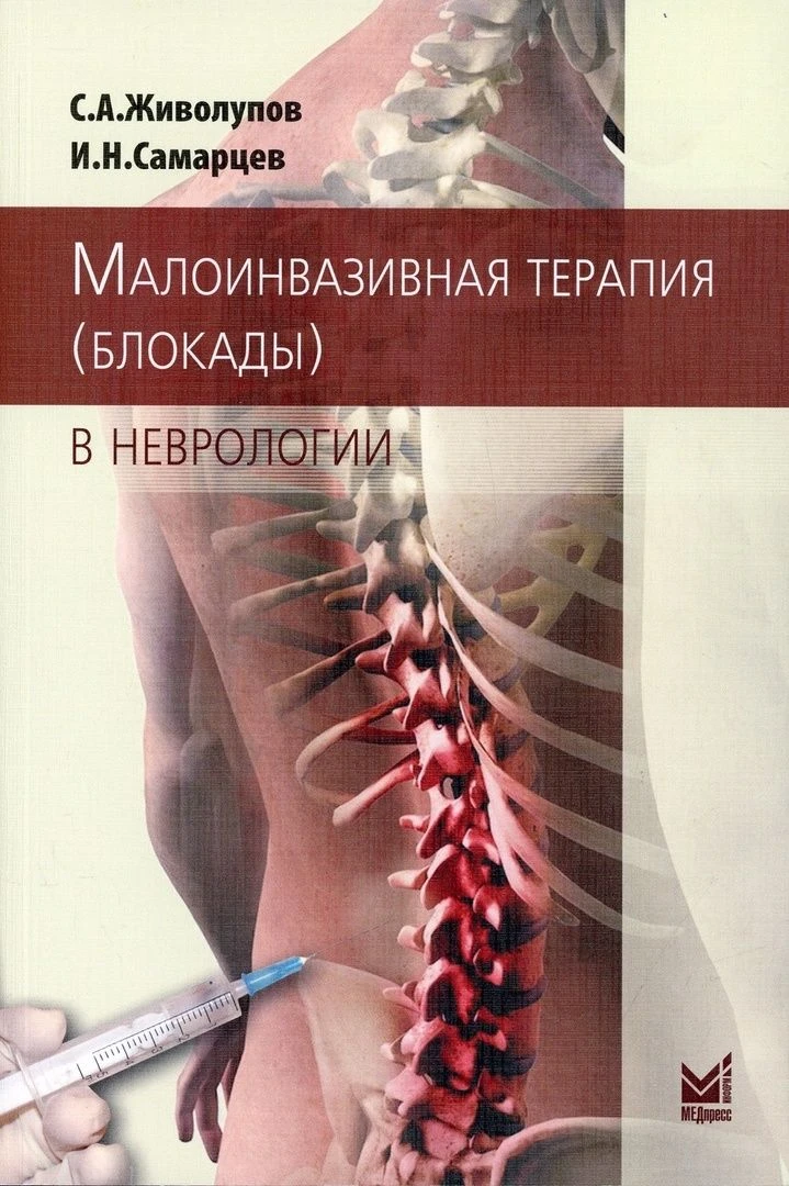 📗 Малоинвазивная терапия (блокады) в неврологии