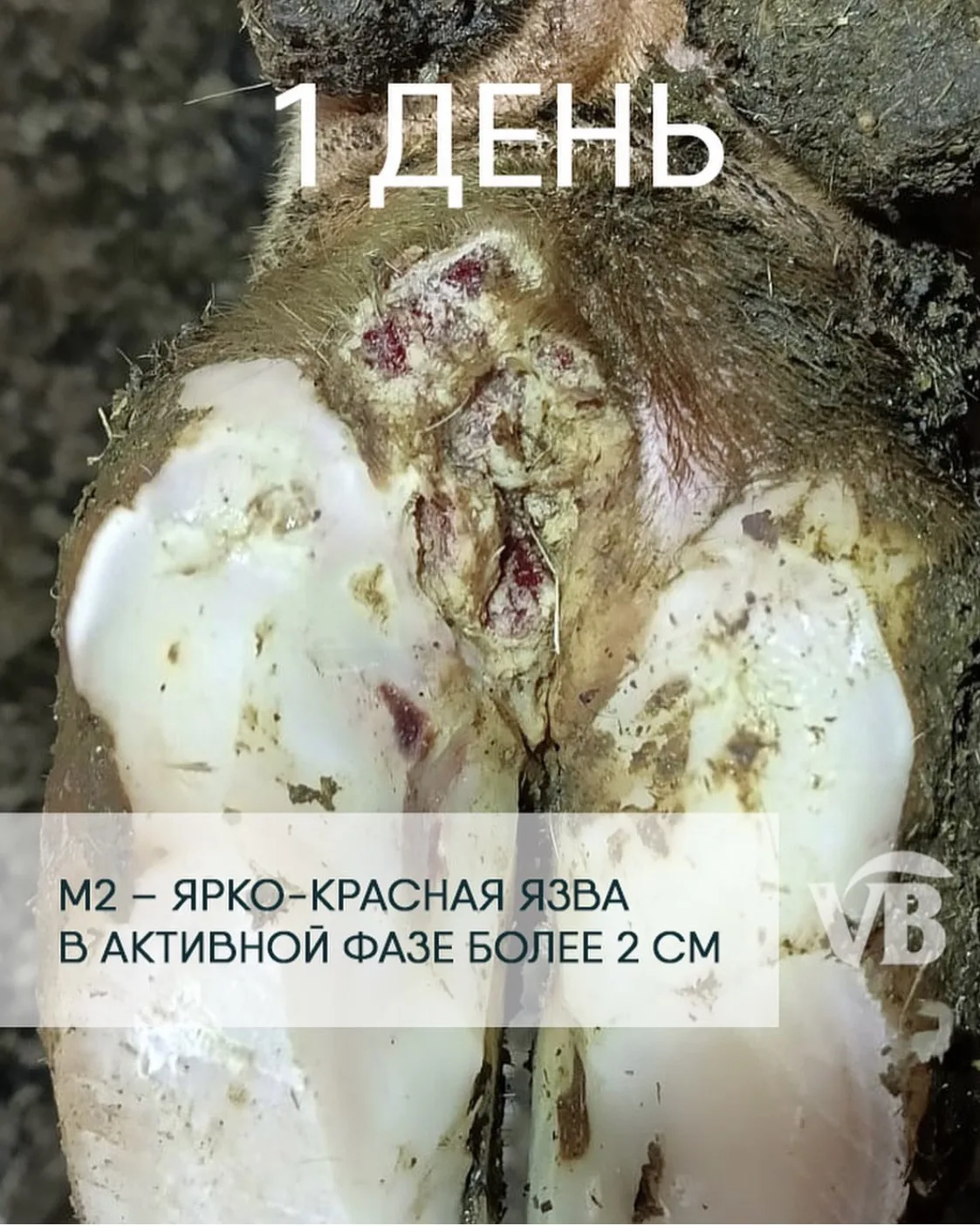 «Само заживет» - однажды сказал ортопед на хозяйстве. Возможно, но риск хронической фор...