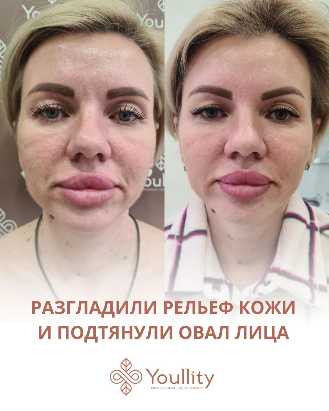 Как сделать так, чтобы работа с возрастными изменениями давала не кратковременный эффек...