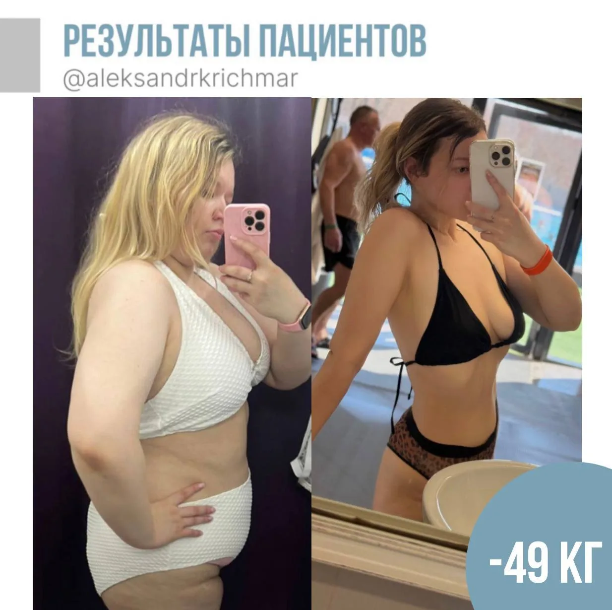 «Сегодня ровно год после моей ПРЖ