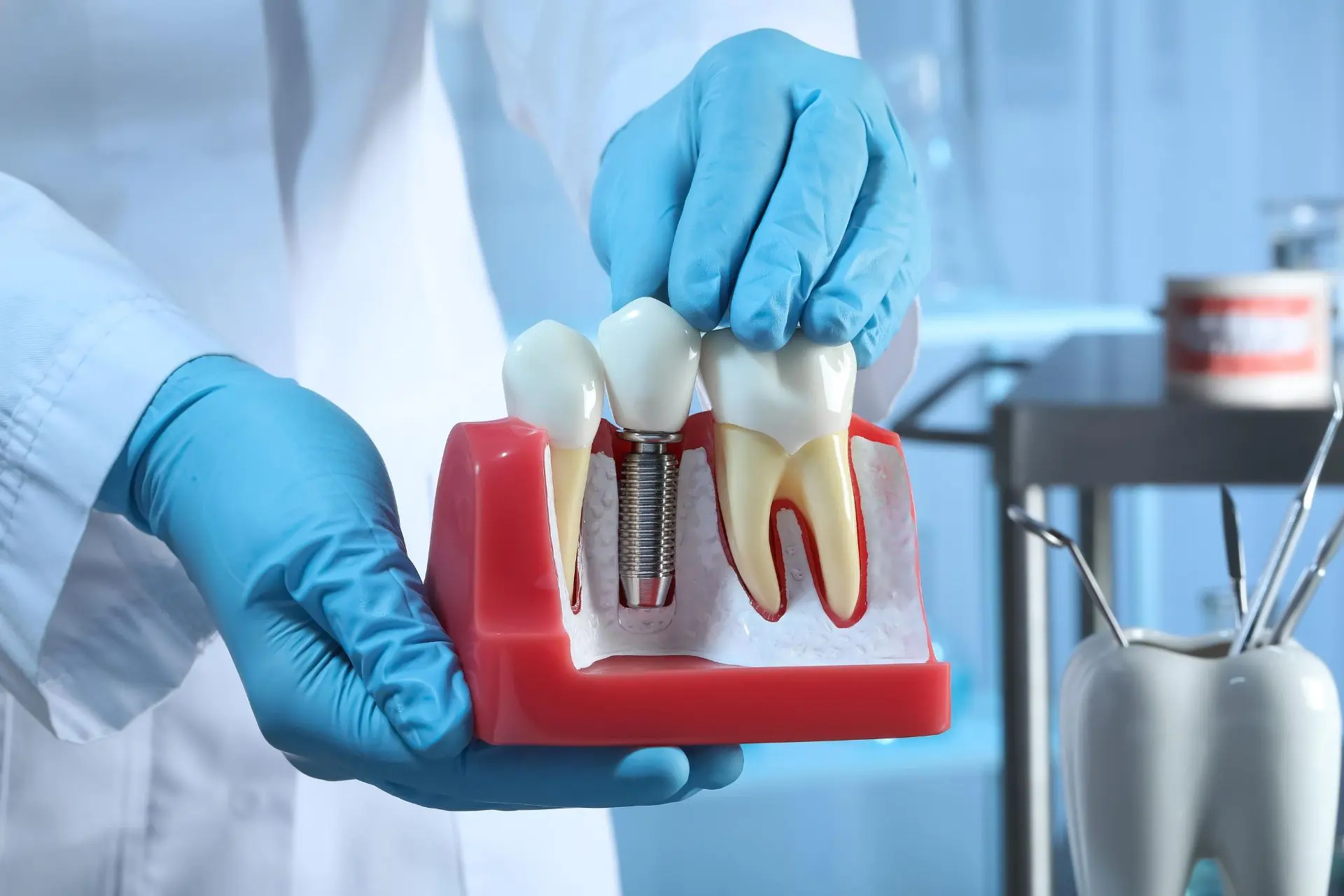 🦷 Люди пытались заменить потерянные зубы задолго до появления современных имплантов