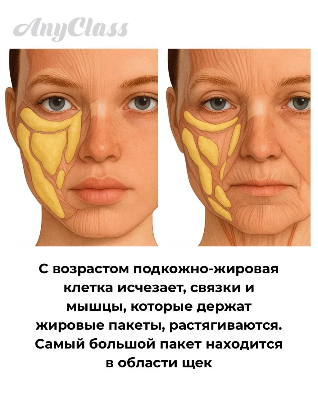 Скуловая мышца - та самая, которая буквально держит лицо.