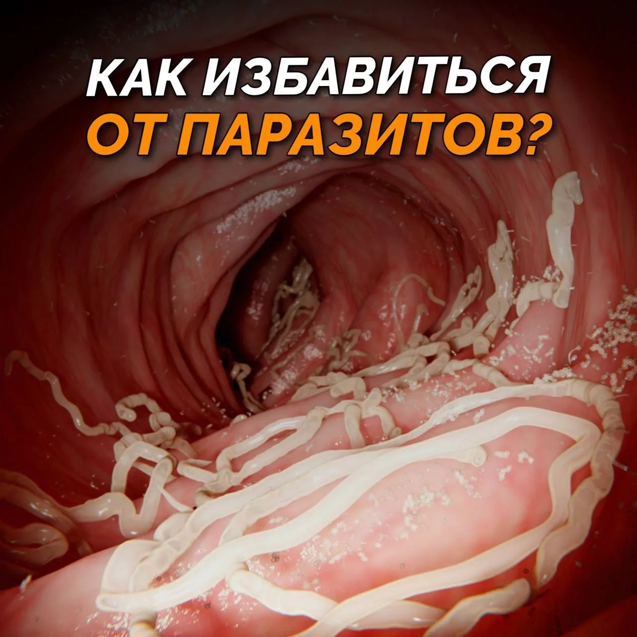 🦠КАЖДЫЙ ЧЕТВЕРТЫЙ ЧЕЛОВЕК В МИРЕ СТРАДАЕТ ОТ ПАРАЗИТОВ