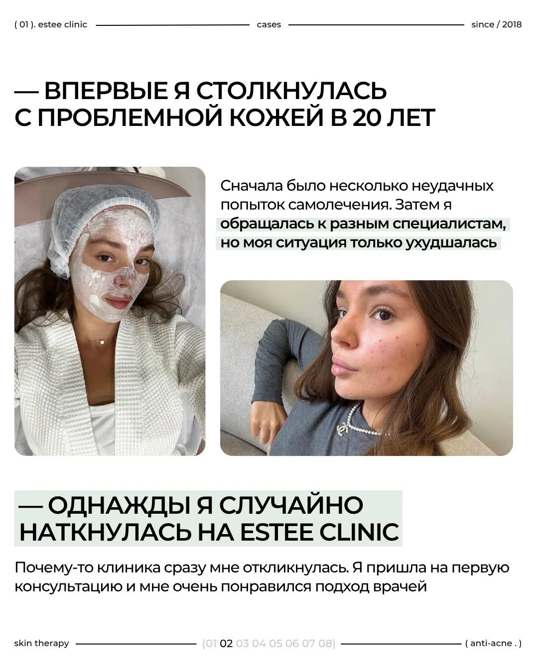 Блогер и пациентка estee clinic — Кристина Благун поделилась своим путем лечения акне🤍