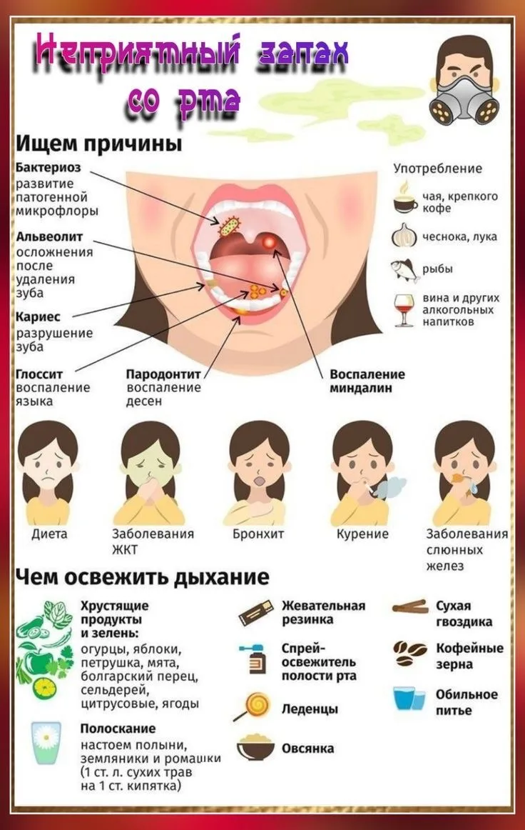 Неприятный запах изо рта (галитоз) чаще всего связан с бактериями в полости рта, но причин может быт