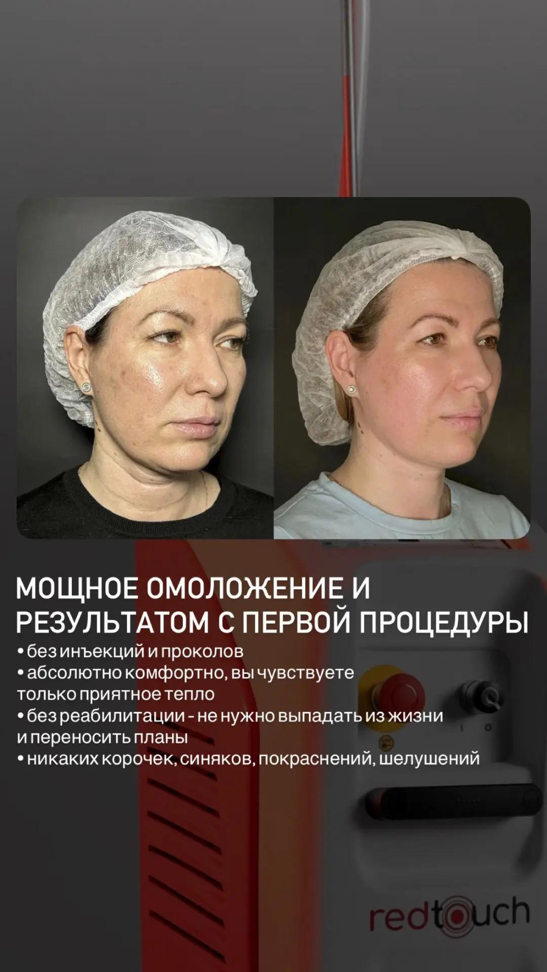 Уникальная новинка в effi! 💥💥💥